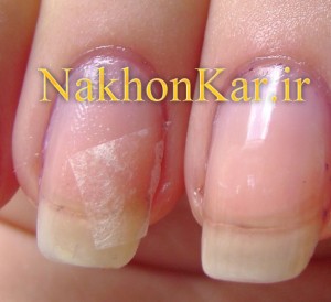 ترمیم ناخن شکسته شده , روش ترمیم ناخن شکسته ,نحوه ترمیم ناخن شکسته,چگونگی , چسباندن ناخن شکسته