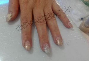 کاشت ناخن ترکی