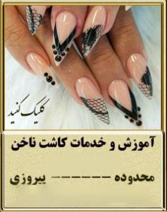 کاشت ناخن پیروزی