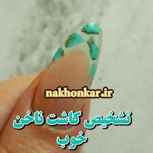 کاشت ناخن خوب