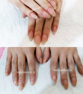 قیمت کاشت ناخن تهران - قیمت کاشت ناخن کرج - قیمت کاشت ناخن - اصفهان - قیمت کاشت ناخن تبریز - قیمت کاشت ناخن اهواز
